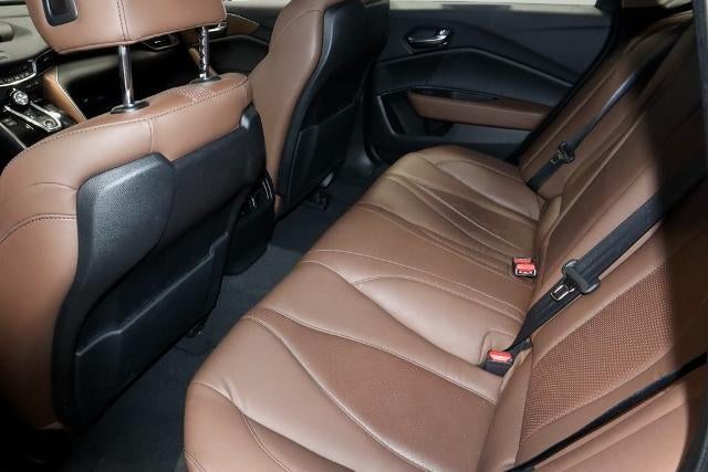 2021 Acura TLX Technology Package